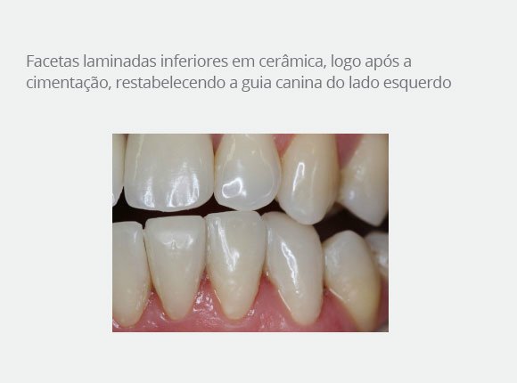 caso-clinico-dr-paulo-vicente-goloni-10