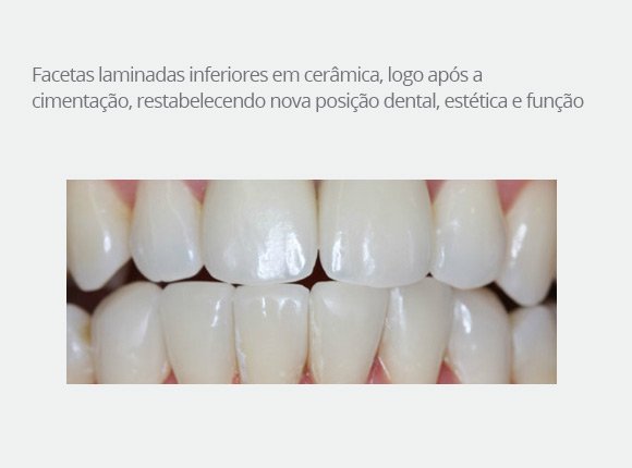 caso-clinico-dr-paulo-vicente-goloni-11