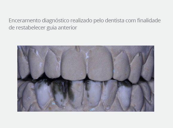 caso-clinico-dr-paulo-vicente-goloni-3