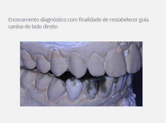 caso-clinico-dr-paulo-vicente-goloni-4