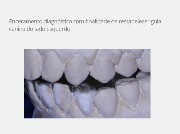 caso-clinico-dr-paulo-vicente-goloni-5