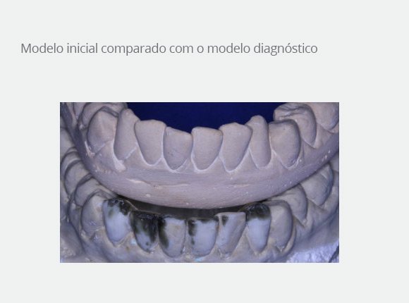 caso-clinico-dr-paulo-vicente-goloni-6