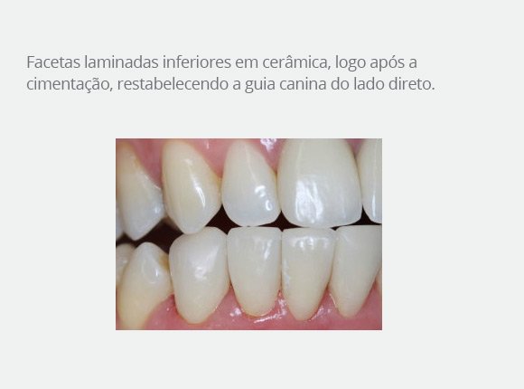 caso-clinico-dr-paulo-vicente-goloni-9