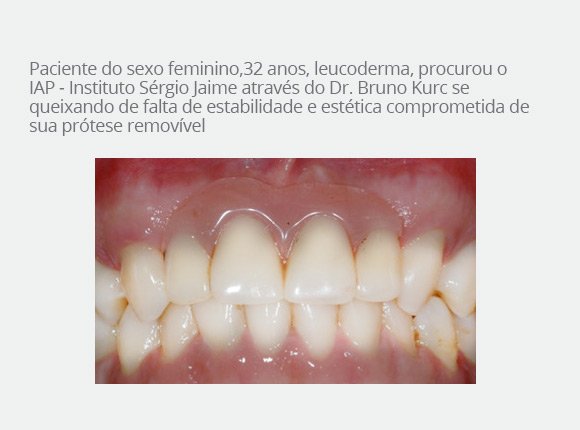 casos-clinicos-dr-bruno-e-dr-sergio-jaime-3