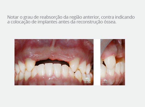 casos-clinicos-dr-bruno-e-dr-sergio-jaime-4