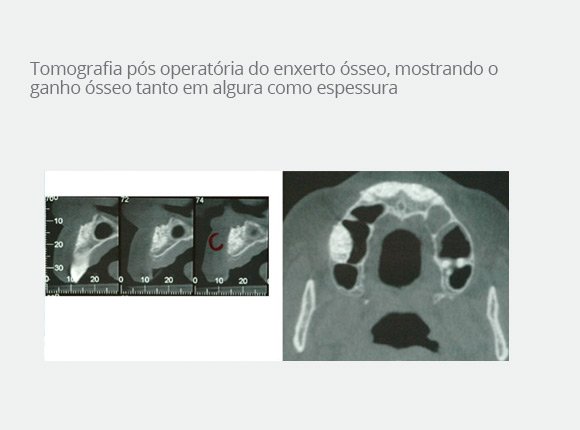 casos-clinicos-dr-bruno-e-dr-sergio-jaime-7