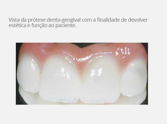 casos-clinicos-dr-bruno-e-dr-sergio-jaime-8