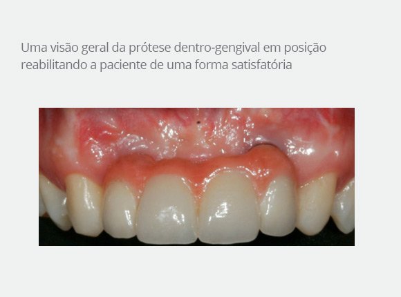 casos-clinicos-dr-bruno-e-dr-sergio-jaime-9