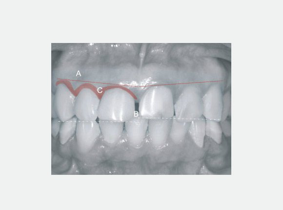 casos-clinicos-dr-jansen-ozaki-e-dr-waldir-romao-jr-2