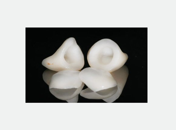 casos-clinicos-dr-jansen-ozaki-e-dr-waldir-romao-jr-7