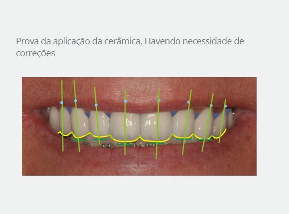 casos-clinicos-dr-mario-takashi-kawagoe-13