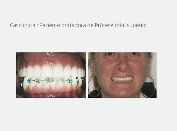 casos-clinicos-dr-mario-takashi-kawagoe-3