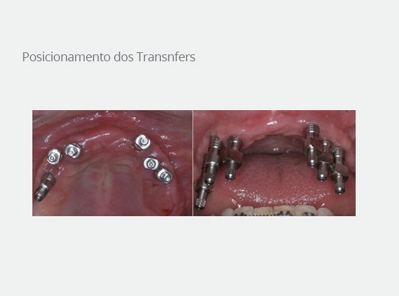 casos-clinicos-dr-mario-takashi-kawagoe-4