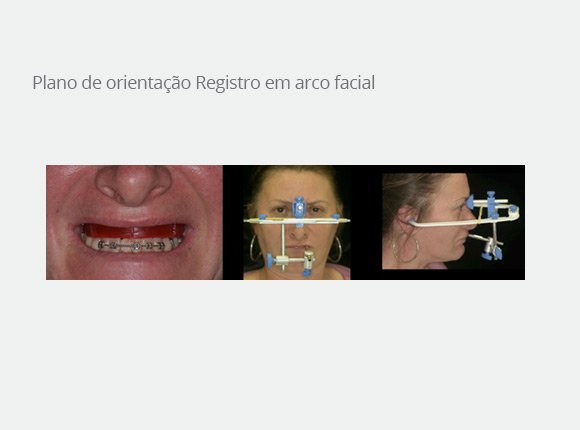 casos-clinicos-dr-mario-takashi-kawagoe-5