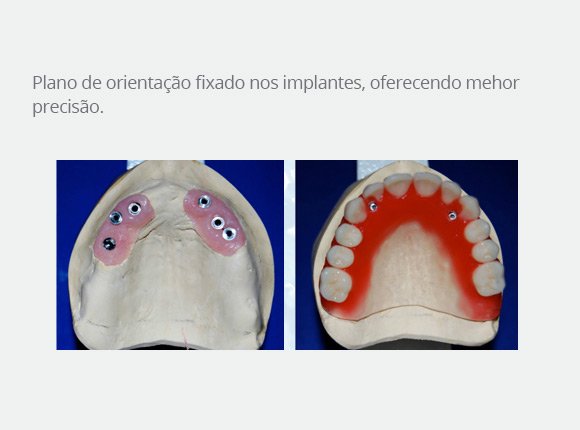 casos-clinicos-dr-mario-takashi-kawagoe-7