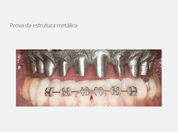 casos-clinicos-dr-mario-takashi-kawagoe-9