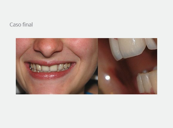 casos-clinicos-dra-ligia-pedroso-111