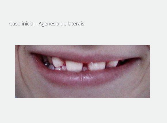 casos-clinicos-dra-ligia-pedroso-23