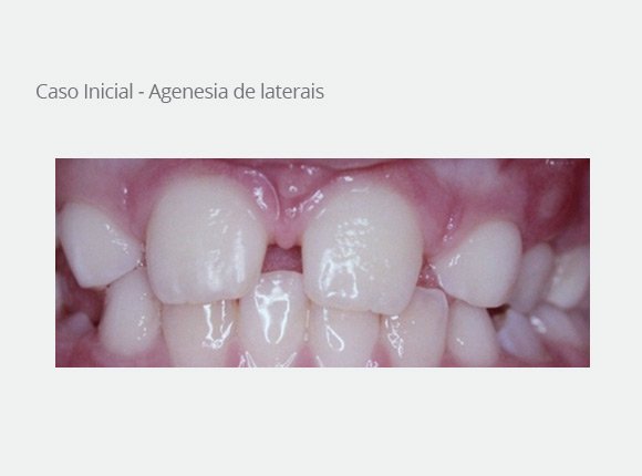 casos-clinicos-dra-ligia-pedroso-31