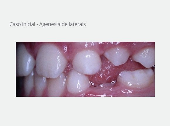 casos-clinicos-dra-ligia-pedroso-41