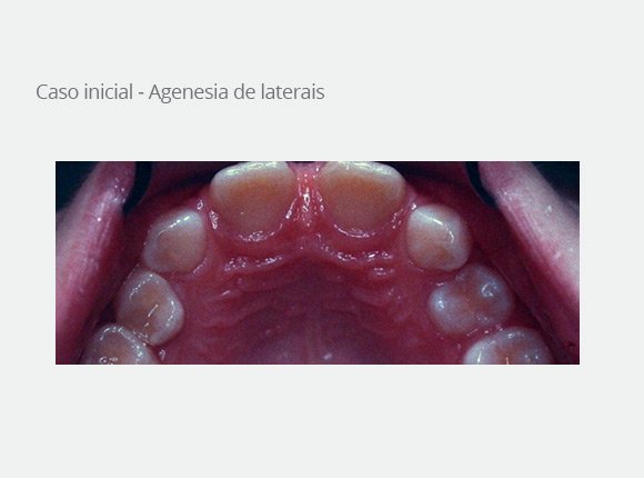 casos-clinicos-dra-ligia-pedroso-51