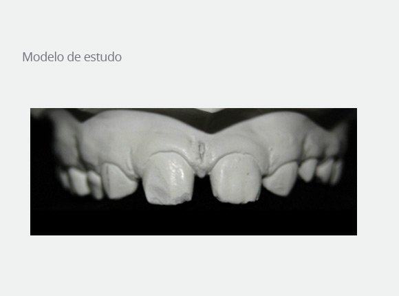 casos-clinicos-dra-ligia-pedroso-61