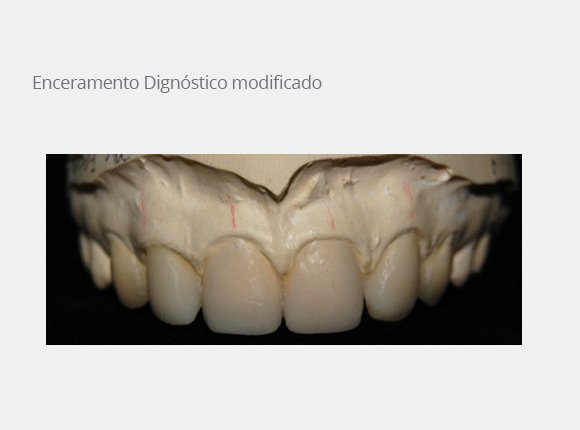 casos-clinicos-dra-ligia-pedroso-71