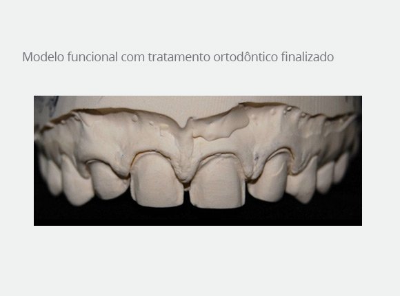 casos-clinicos-dra-ligia-pedroso-81