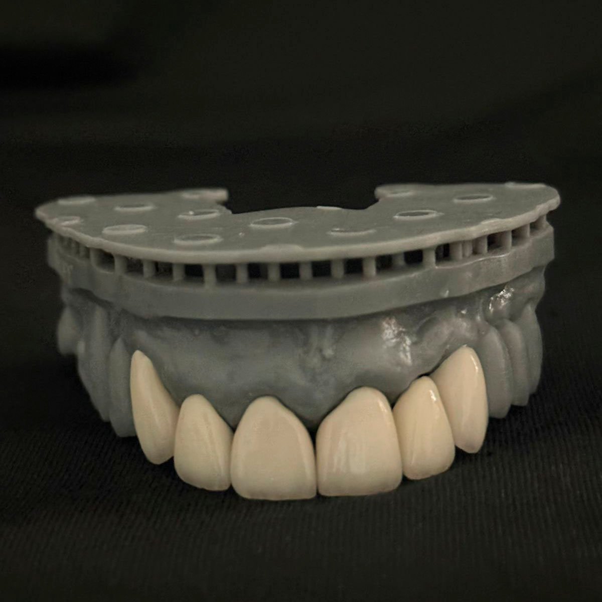 Coroas em dissilicato de litio