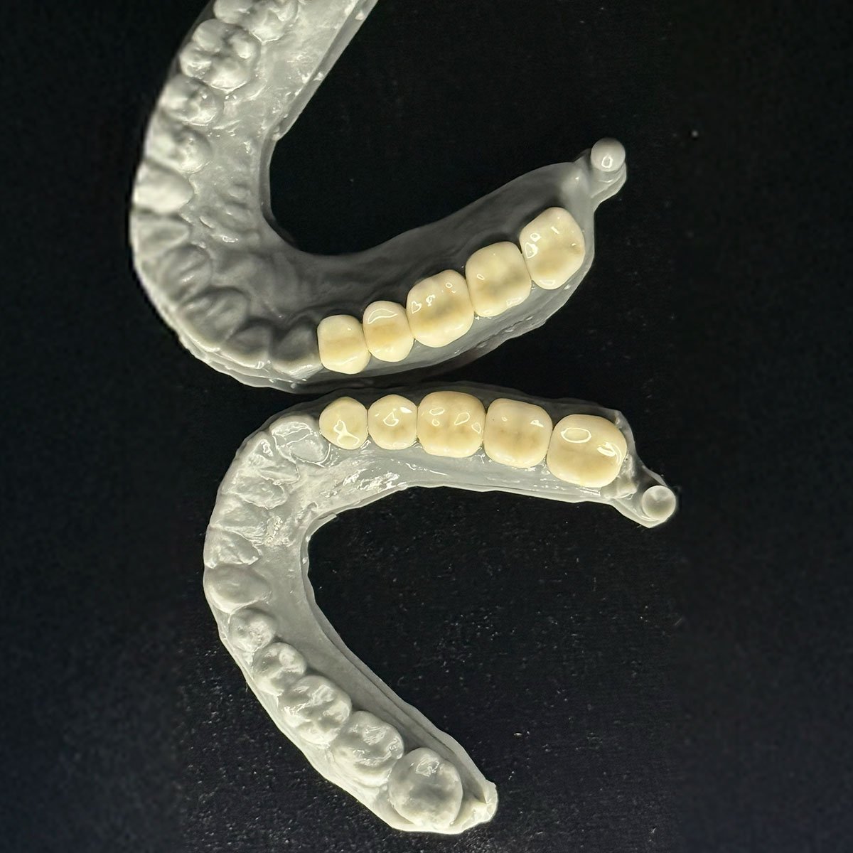 ELEMENTO SOBRE DENTE EM ZIRCONIA