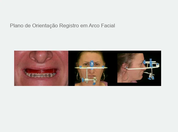 Plano de Orientação Registro em Arco Facial