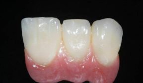 resina-sinfony-labso054